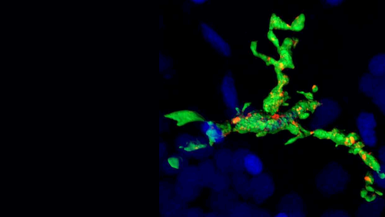Investigating Zebrafish Microglia with Confocal Microscopy to Understand Brain Development