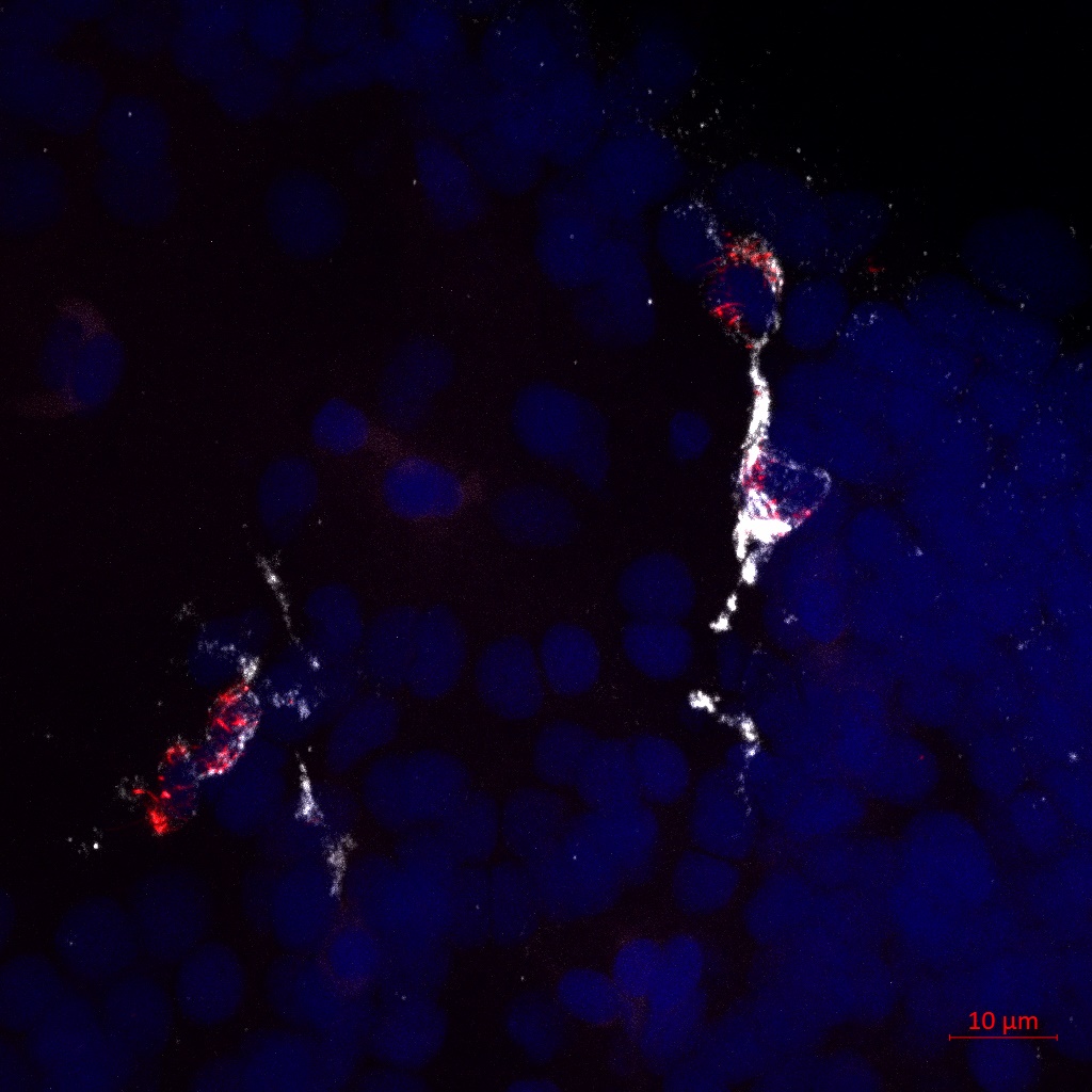 Microglia Within the Hindbrain Region