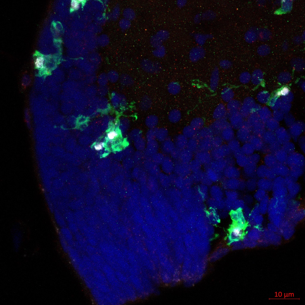 Microglia Enriched in the Optic Tectum (OT)