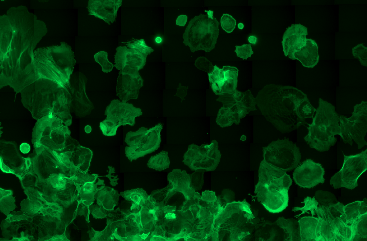 LifeAct-GFP expressing astrocytes under 2g hypergravity imaged using ZEISS Axio Observer on the DLR Hyperscope.
