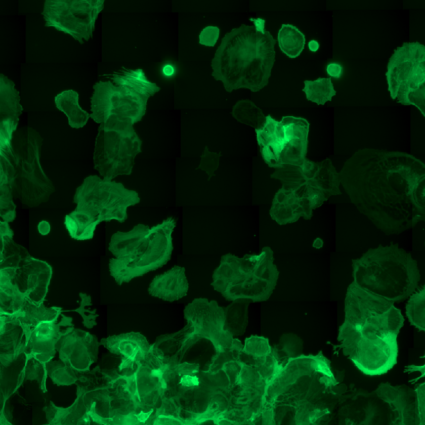 LifeAct-GFP expressing astrocytes under 2g hypergravity imaged using ZEISS Axio Observer on the DLR Hyperscope.