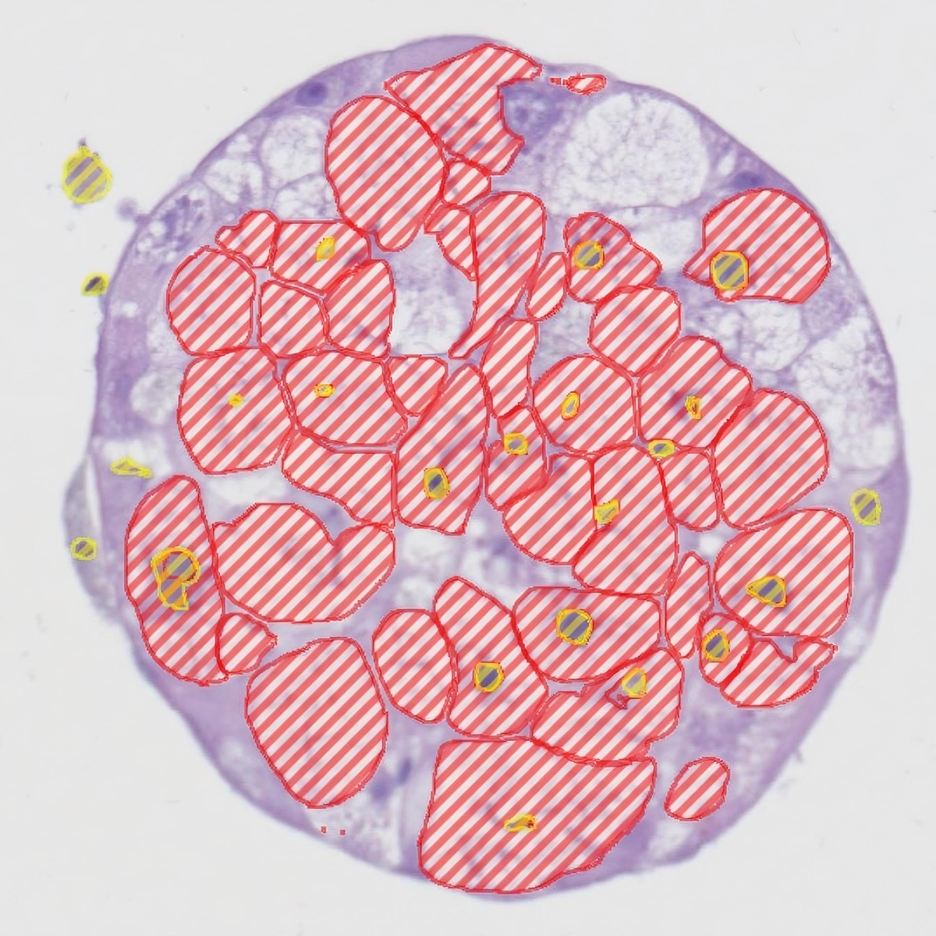 Microscopic view of a liver microtissue sample, featuring AI-generated markup. The hepatocyte is predominantly purple, with irregular red stripes indicating the cytoplasmic areas and yellow highlights marking the nuclei. This color differentiation emphasizes specific cellular structures and regions within the tissue, enhancing the visualization of cellular morphology.