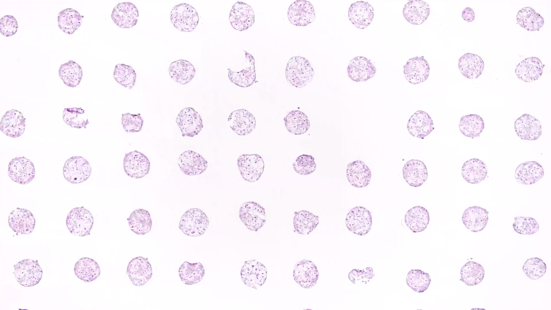 Video loop that shows an overview of many samples of liver microtissue, stained in violet, several samples in a row, many rows below each other. the video zooms in strongly on a sample. Annotations in different colours with yellow segments show hepatocyte nuclei and red segments showing hepatocyte cytoplasm areas , generated by AI-supported imaging software, appear in the sample.