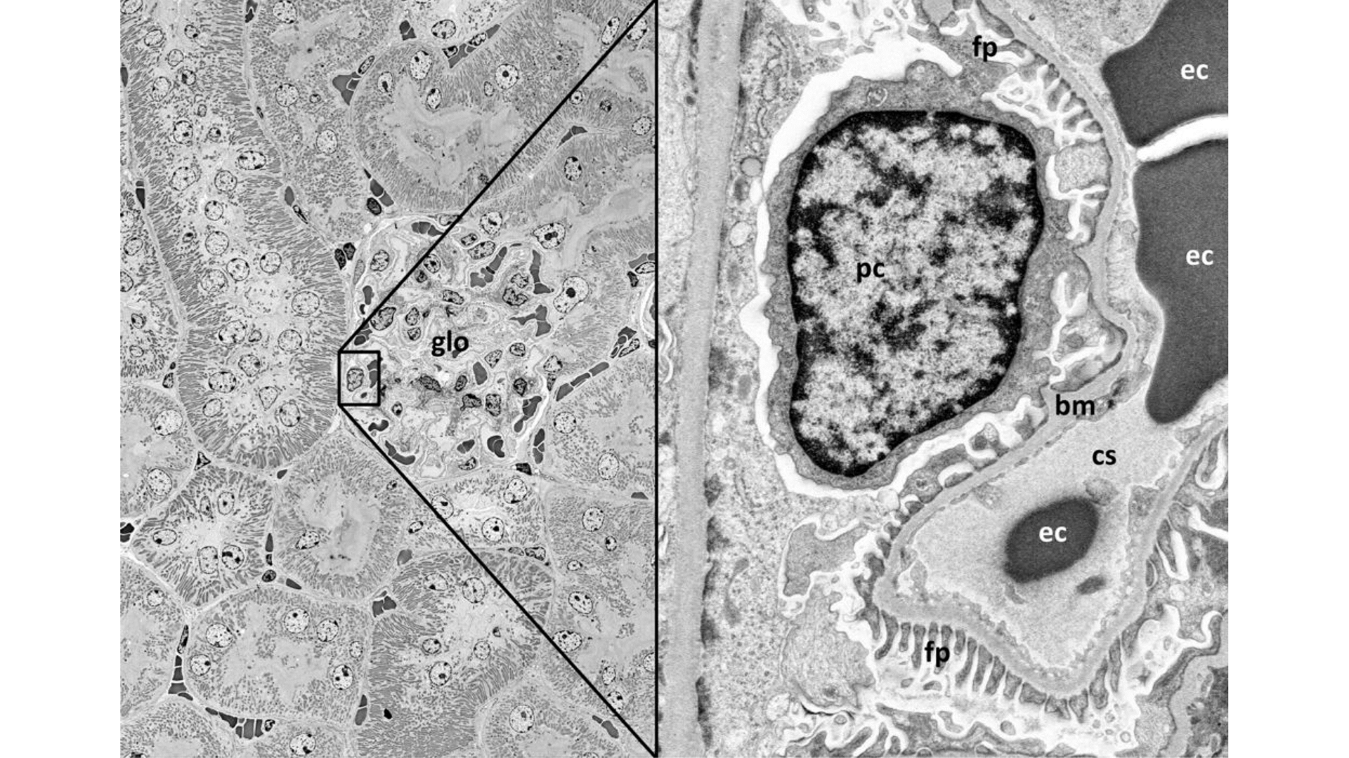 Digital zooming from kidney tissue overview into glomerulus (glo). Right side: podocyte (pc) with foot processes (fp), basement membrane (bm) and capillary space (cs) with erythrocystes (ec). Imaged with ZEISS GeminiSEM.
