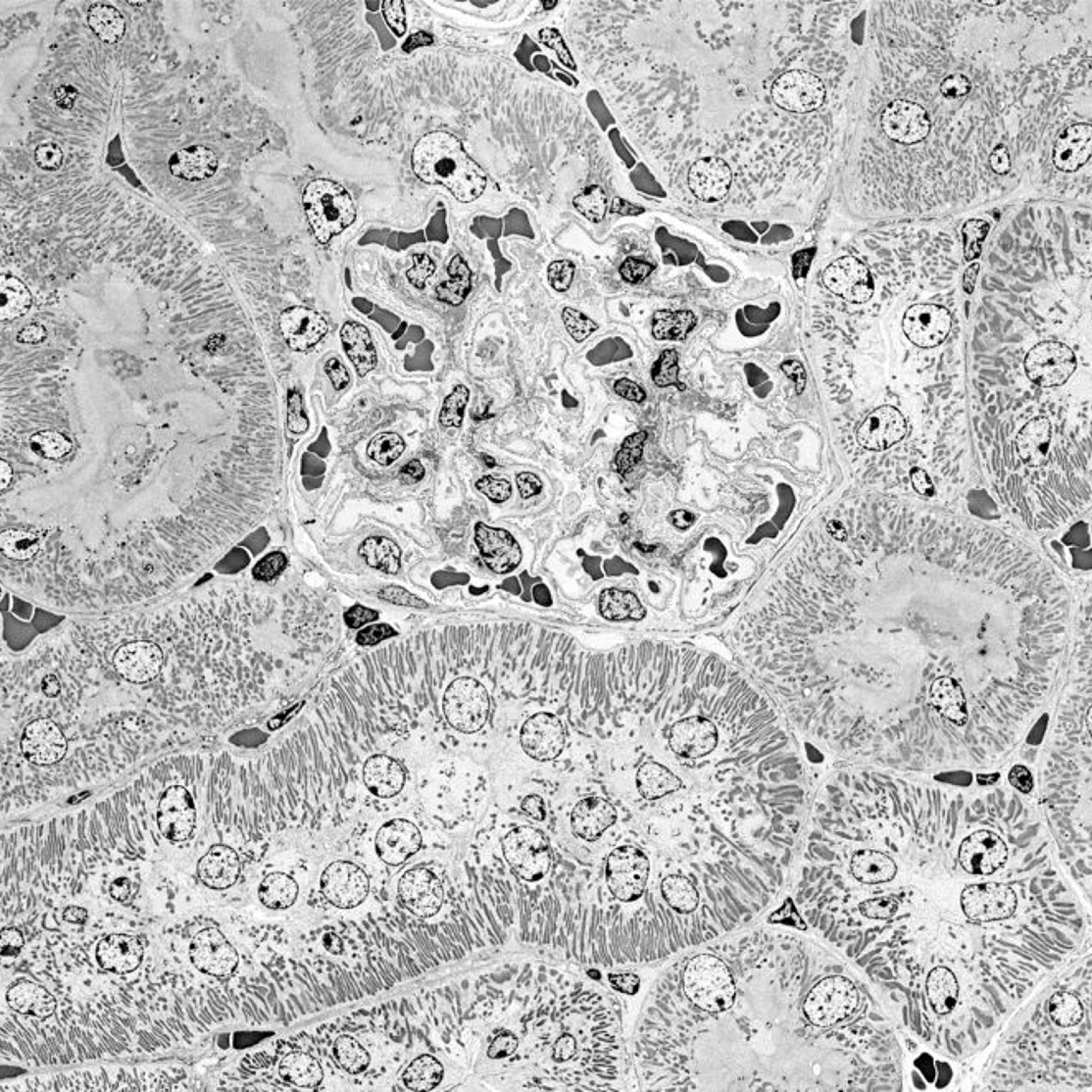 Mouse kidney glomerulus in center surrounded by various renal tubules. Imaged with the ZEISS GeminiSEM scanning electron microscope.