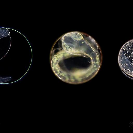 Fish eggs in spring plankton