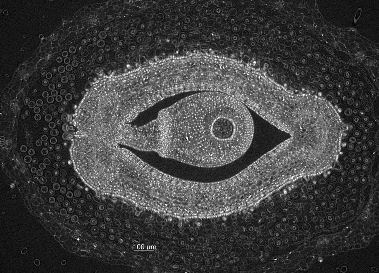 Soy ovole, X-ray microscopy, Keith Duncan