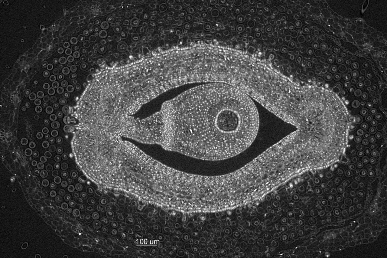 Soy ovole, X-ray microscopy, Keith Duncan