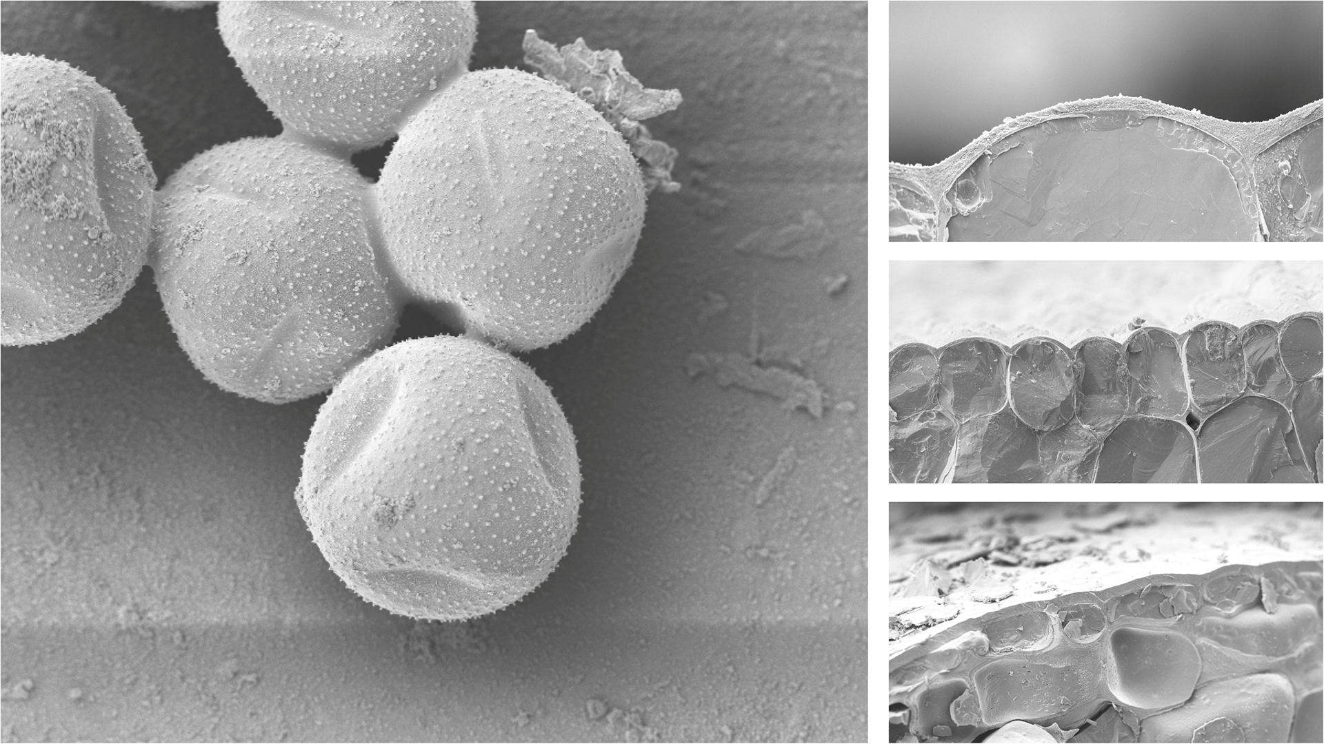 First cellular ultrastructure images of moonflower plant using scanning electron microscopy
