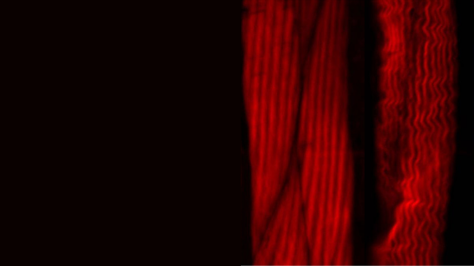 Researchers Use C. elegans and Stereo Zoom Microscopy to Study Aging and Age-Related Diseases