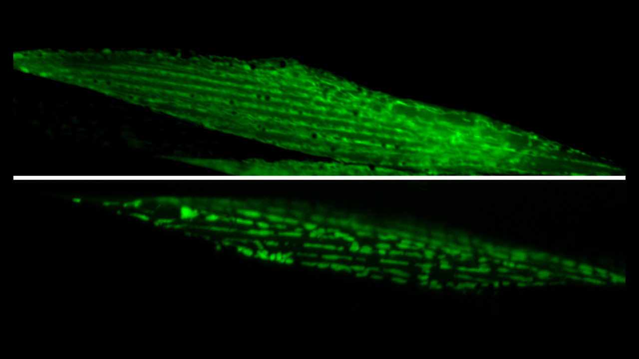 Top: Mitochondria in healthy muscle of C. elegans. Bottom: Fragmented mitochondria in the muscle after induction of aggregation of proteins in the germline. Imaged using ZEISS Axio Zoom.V16.