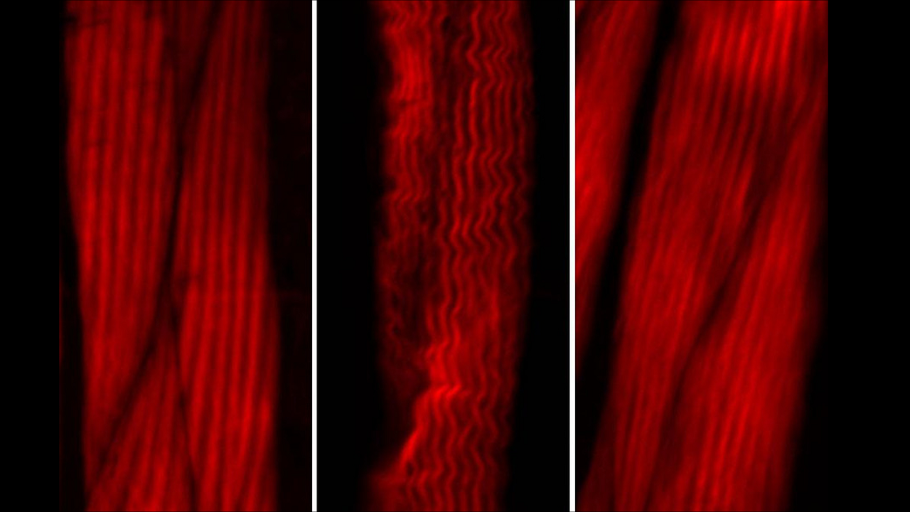 Left: Muscle actin cytoskeleton in young worms. Center: Muscle actin cytoskeleton in old worms, showing destabilization. Right: Preventing destabilization of muscle cytoskeleton in old worms by lowering the age-dysregulated high levels of EPS-8, a regulator of actin cytoskeleton. Imaged using ZEISS Axio Zoom.V16.