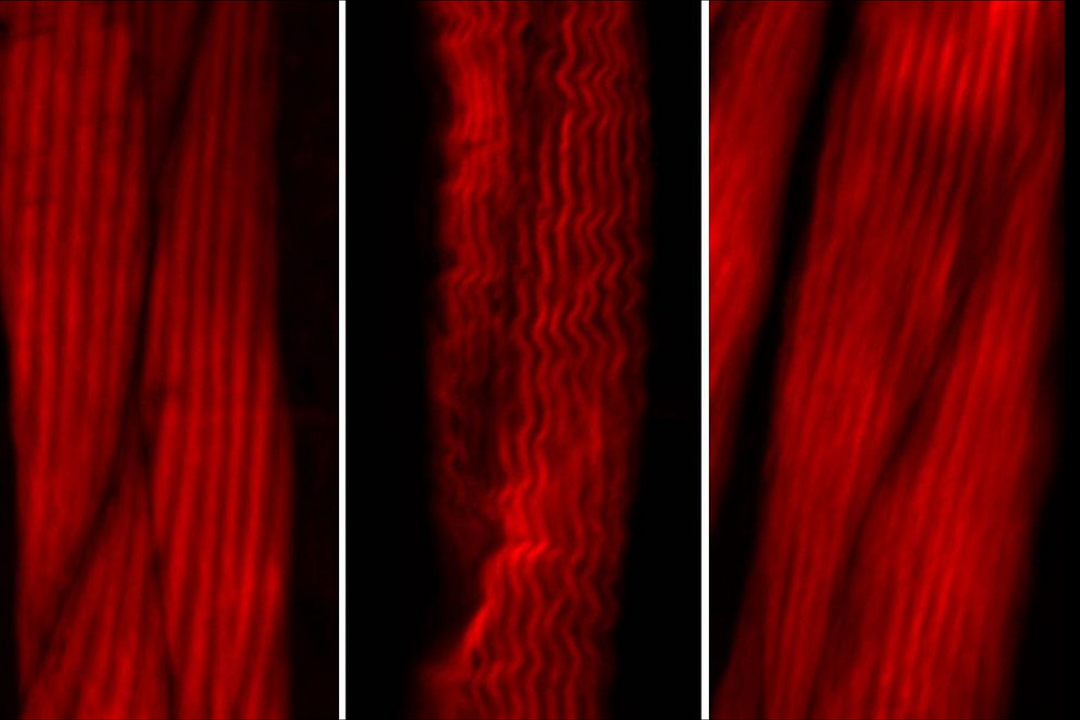 Left: Muscle actin cytoskeleton in young worms. Center: Muscle actin cytoskeleton in old worms, showing destabilization. Right: Preventing destabilization of muscle cytoskeleton in old worms by lowering the age-dysregulated high levels of EPS-8, a regulator of actin cytoskeleton. Imaged using ZEISS Axio Zoom.V16.