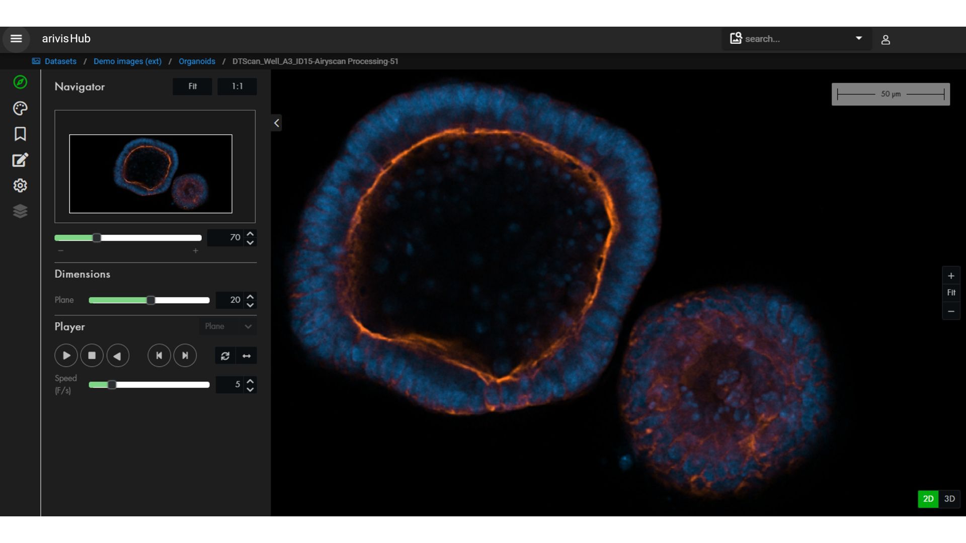 A Screenshot of the ZEISS arivis Hub software. A slice of organoid microscopy image is seen while some indicators on the screen show the processing is running. 