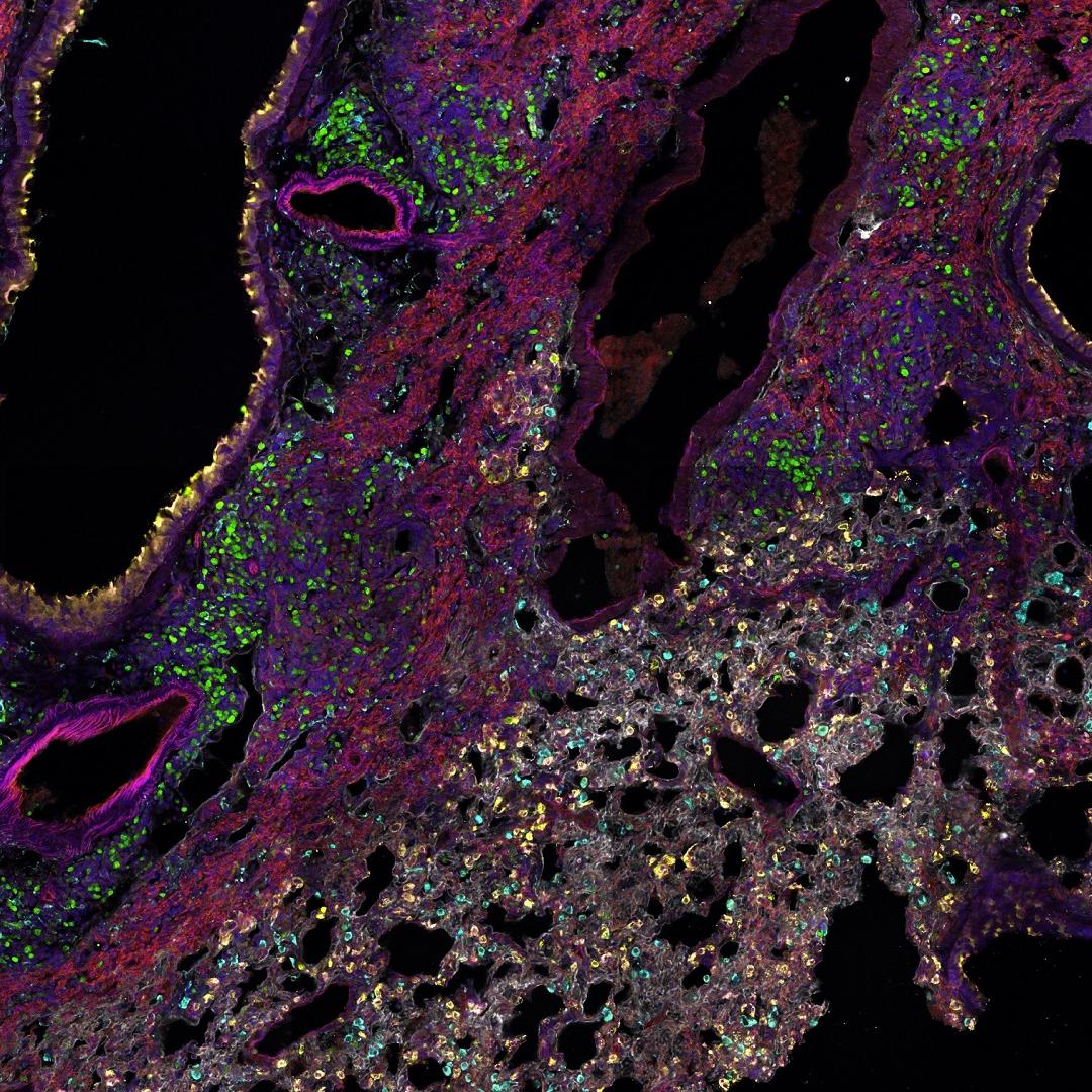 Spectral microscopy is used in an eight-label panel for spatial biology to identify various macrophage population niches.