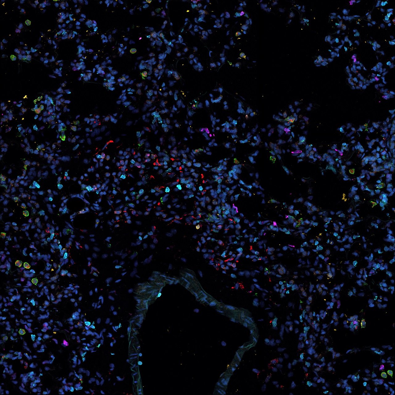 Spatial biology of immune cells in lung tissue using spectral imaging with ZEISS LSM 980 confocal