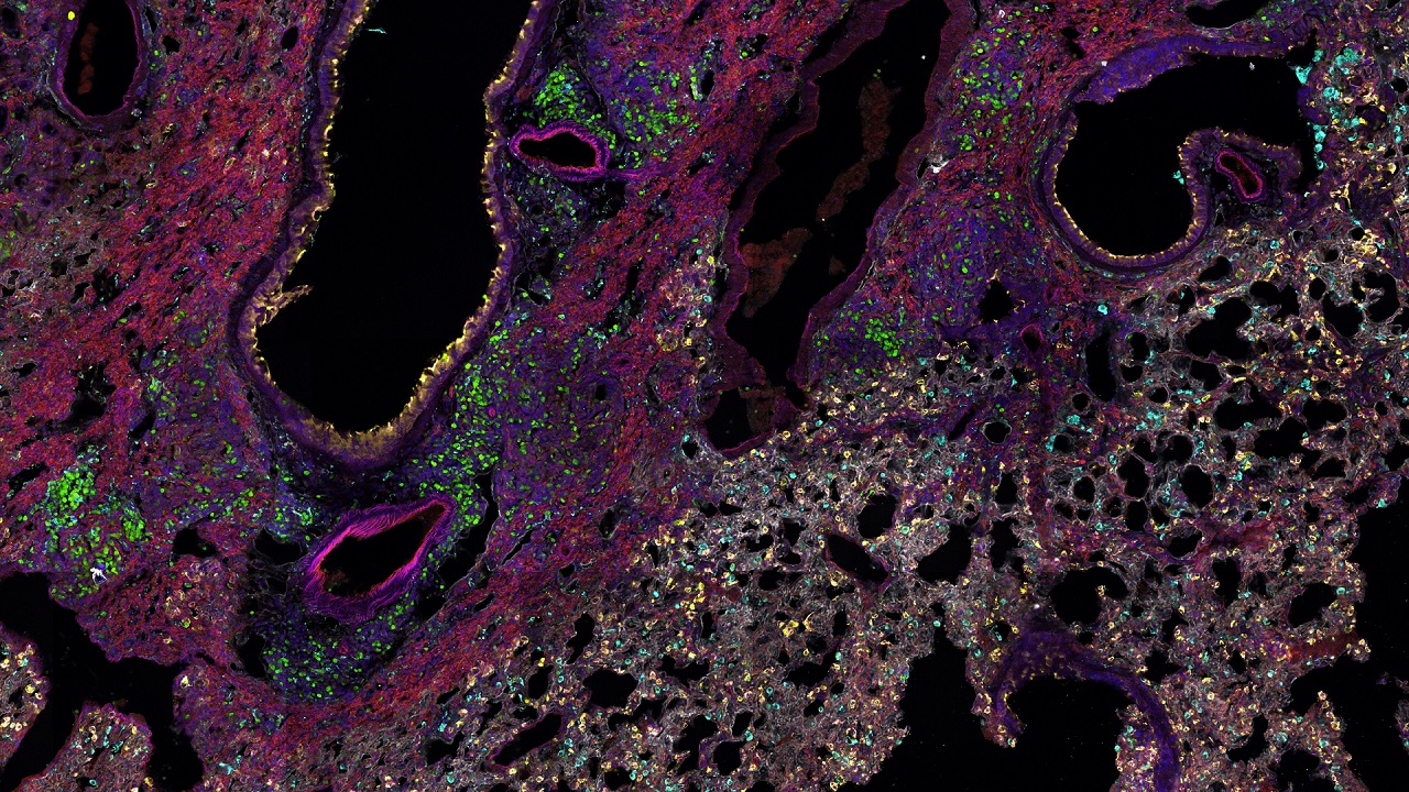 Eight color spectral imaging of immune cells in lung tissue using ZEISS LSM 980 laser scanning confocal