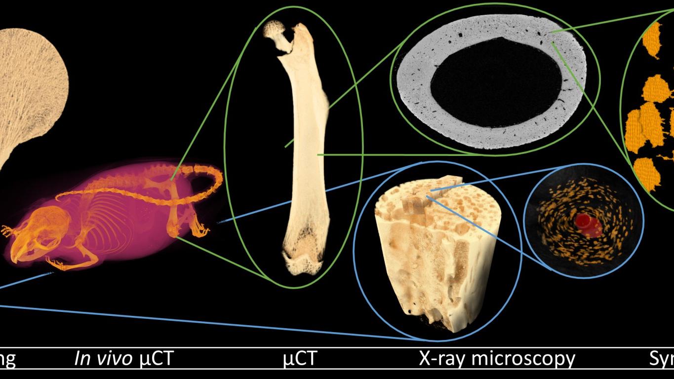 Structural Characterization of Complex Biomineralized Materials With 3D X-Ray Microscopy