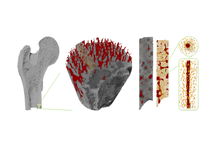 Human mid-femur, imaged with the ZEISS Xradia 620 Versa X-ray microscope