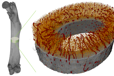 Mouse femur, imaged with the ZEISS Xradia 620 Versa X-ray microscope