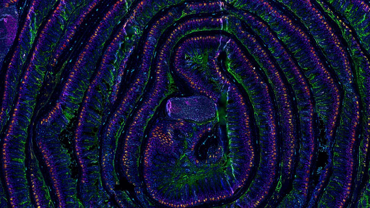 The Intricate Network of Immune Cells Revealed by Multiplex Tissue Microscopy