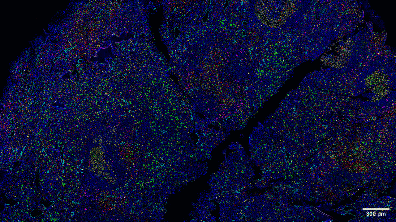 1 µm section of a formalin fixed paraffin-embedded human lymph node. Section was stained with a 14 CODEX antibody panel. Image shows some essential markers to distinguish mononuclear phagocytes (CD68 in red, HLA-DR in green, CD11c in magenta). To delineate major anatomical structures, such as blood vessels, CD31 is shown in cyan. Proliferation marker Ki67 (yellow) delineates germinal centers. Blue signals correspond to DAPI nuclear staining. Acquisition was done with a ZEISS Axio Observer microscope and processing with the Akoya CODEX Processor.