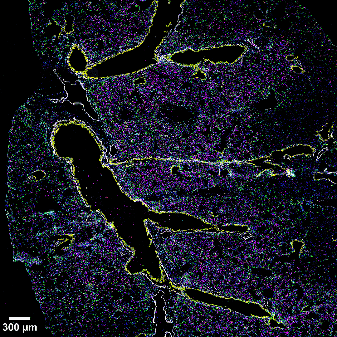 3 µm frozen section of the left mouse lung 3 days after intranasal stimulation with LPS. Section was stained with a 37 CODEX antibody panel. Image shows the canonical markers of mononuclear phagocytes (CD11c in red, MHCII in green, F4/80 in cyan, CD11b in magenta). To delineate major anatomical structures, such as lung airways and blood vessels, EpCAM (yellow) and SMA (gray) are displayed. Blue signals correspond to DAPI nuclear staining. Acquisition was done with a ZEISS Axio Observer microscope and processing with the Akoya CODEX Processor.