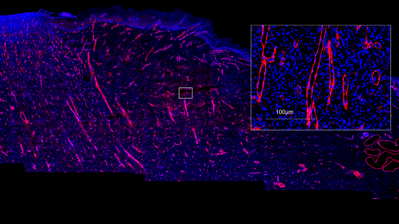 Biofilm infected porcine burn wound stained for smooth muscle actin (red) and nuclei (DAPI/blue). Image acquired with ZEISS Axioscan digital slide scanner.