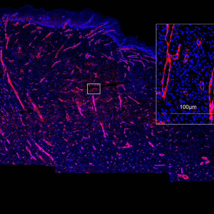 Biofilm infected porcine burn wound stained for smooth muscle actin (red) and nuclei (DAPI/blue). Image acquired with ZEISS Axioscan digital slide scanner.