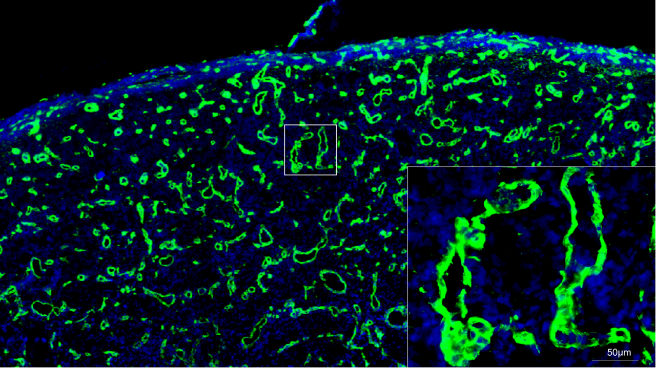 Biofilm infected porcine burn wound stained for collagen (green) and nuclei (DAPI/blue). Images collected with ZEISS Axioscan digital slide scanner.