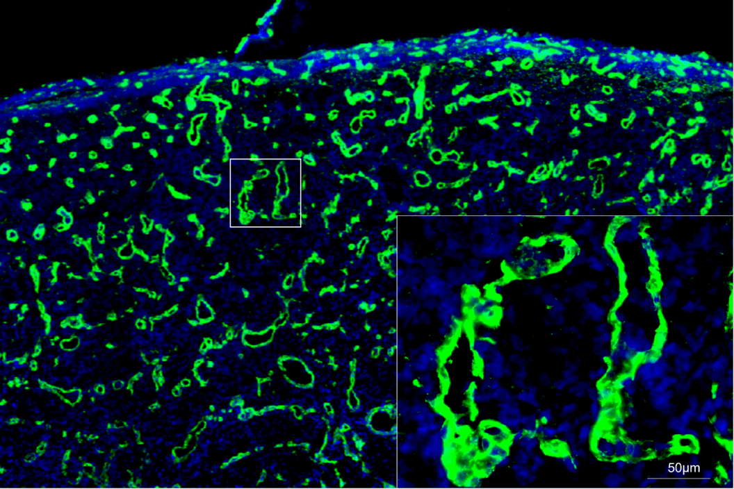 Biofilm infected porcine burn wound stained for collagen (green) and nuclei (DAPI/blue). Images collected with ZEISS Axioscan digital slide scanner.