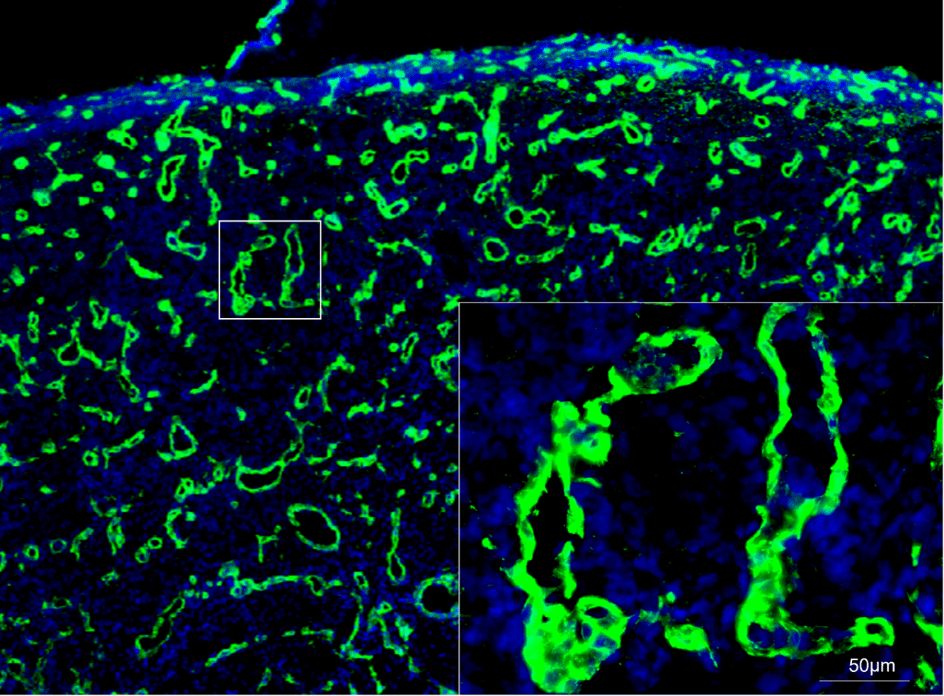 Biofilm infected porcine burn wound stained for collagen (green) and nuclei (DAPI/blue). Images collected with ZEISS Axioscan digital slide scanner.