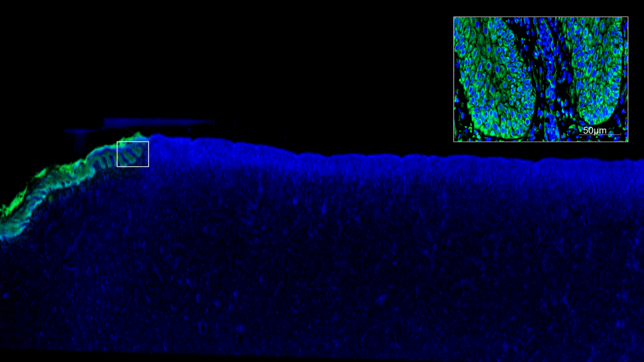 Biofilm infected porcine burn wound stained for tight junctions (green) and nuclei (DAPI/blue). Images collected with ZEISS Axioscan digital slide scanner.