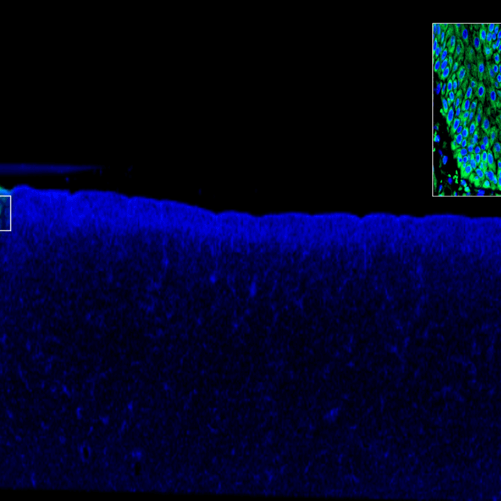 Biofilm infected porcine burn wound stained for tight junctions (green) and nuclei (DAPI/blue). Images collected with ZEISS Axioscan digital slide scanner.
