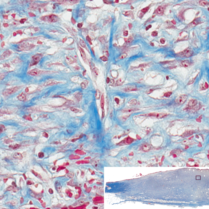 Masson’s trichrome staining of whole mount cross sections of infected porcine burn wounds. Staining results in blue-black nuclei, blue collagen, and light pink/red cytoplasm. Epidermal cells appear reddish. Imaged with ZEISS Axioscan digital slide scanner.