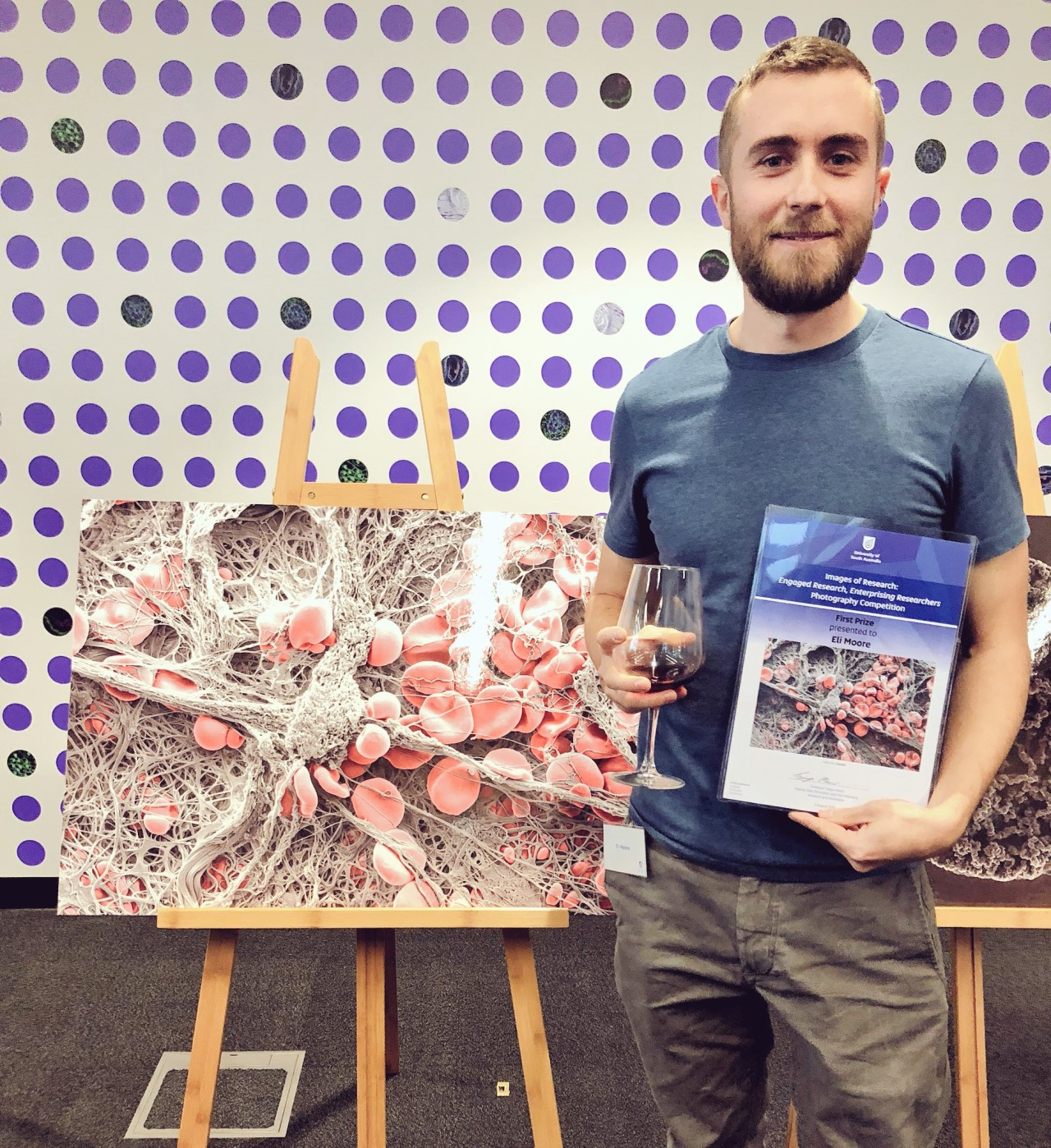 Dr Eli Moore and his image “Clotted” - first prize of the Images of Research Photography Competition 2018 of the University of South Australia.