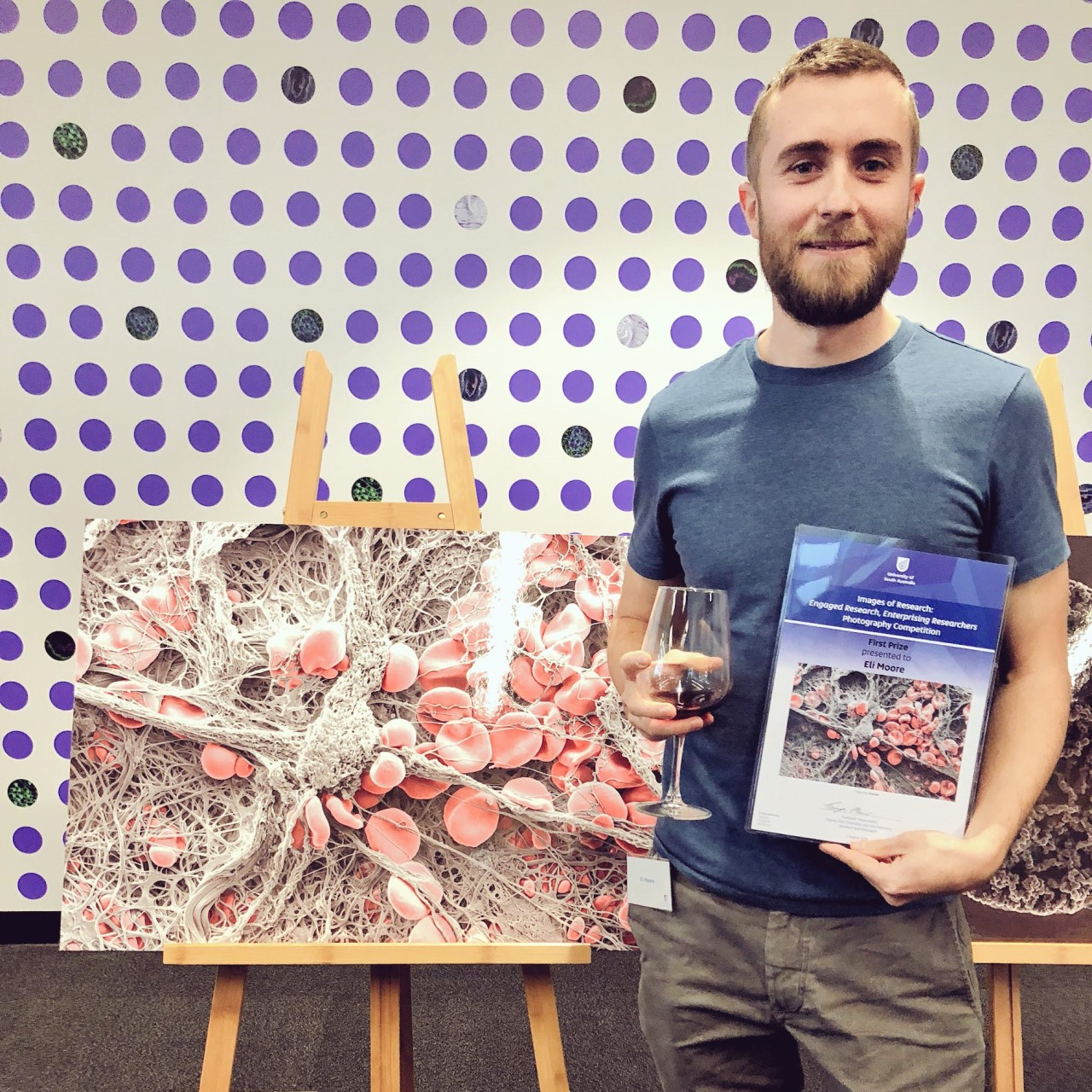 Dr Eli Moore and his image “Clotted” - first prize of the Images of Research Photography Competition 2018 of the University of South Australia.