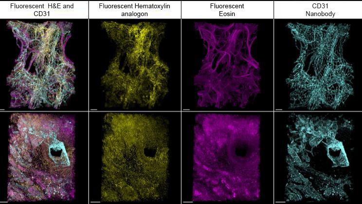 ZEISS Lightsheet 7 | Blood vasculature in healthy and tumor lung tissue samples