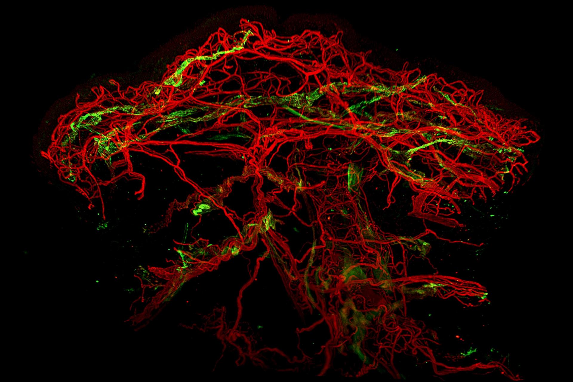 ZEISS Lightsheet 7 | Blood (red) and lymphatic vessels (green) in healthy human skin.