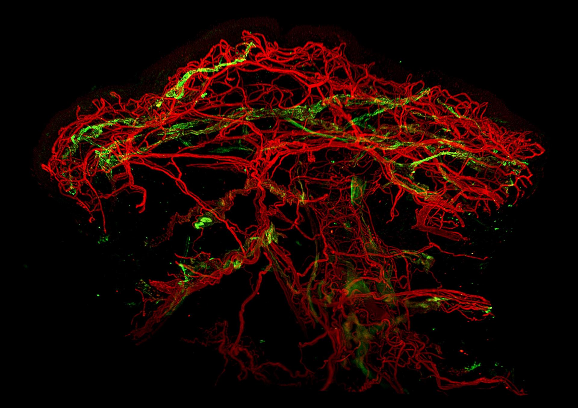 ZEISS Lightsheet 7 | Blood (red) and lymphatic vessels (green) in healthy human skin.