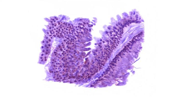 Transforming Histopathology: Fully Automated Tissue Preserving Solutions for Enhanced Diagnostic Accuracy