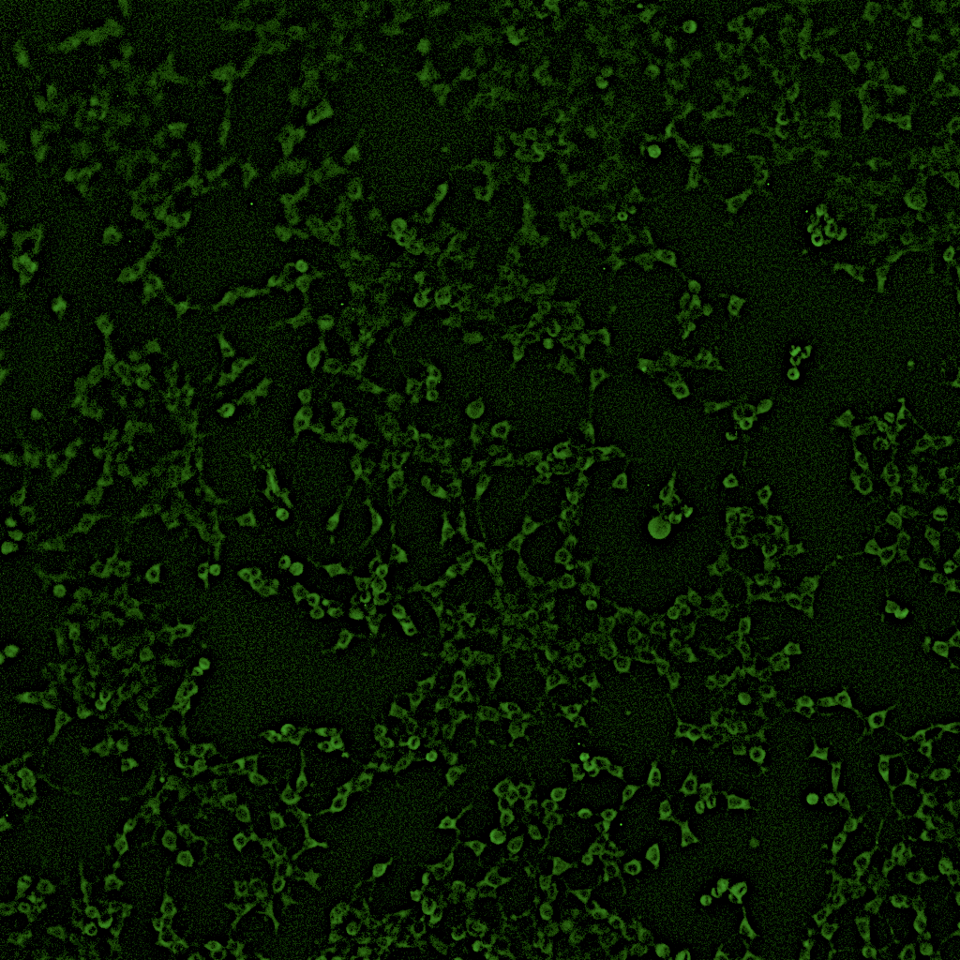 Human embryonic kidney cells (HEK293) stained for RBBP6