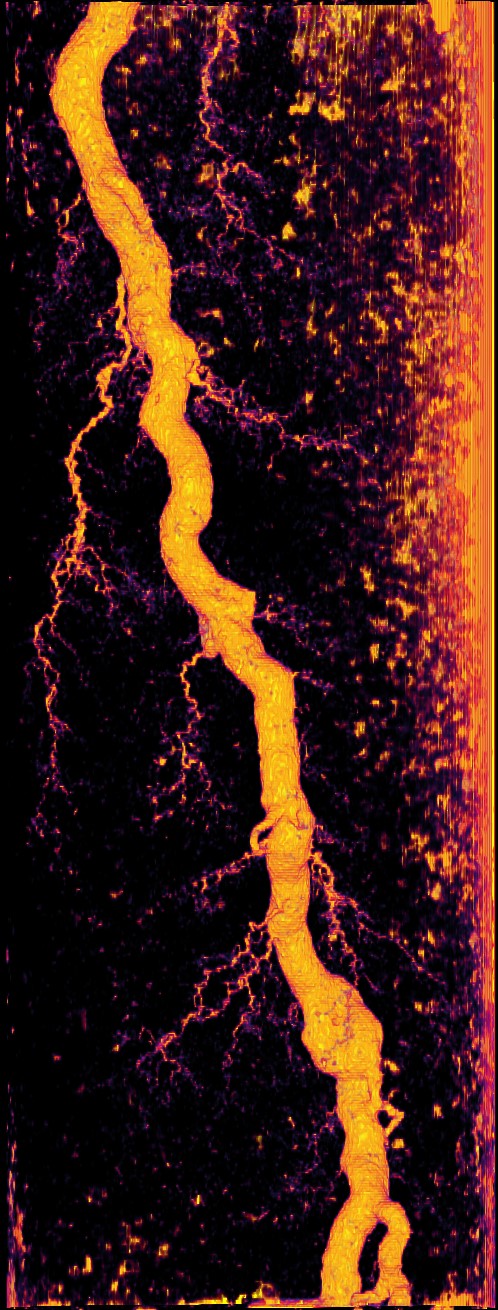 Wormhole development in a limestone sample exposed to CO2 acidified brine