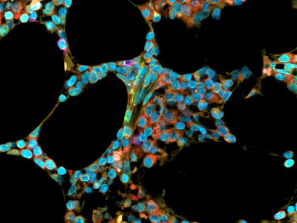 ZEISS LSM 980 | Bone marrow biopsy