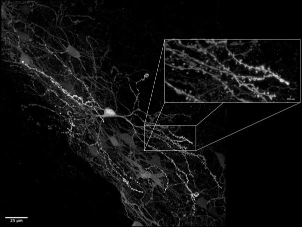 ZEISS LSM 980 | Mouse cortex