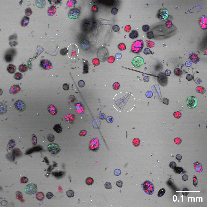 Microscopic animated view of moving cells in various colors on a grey background with scale indicator.