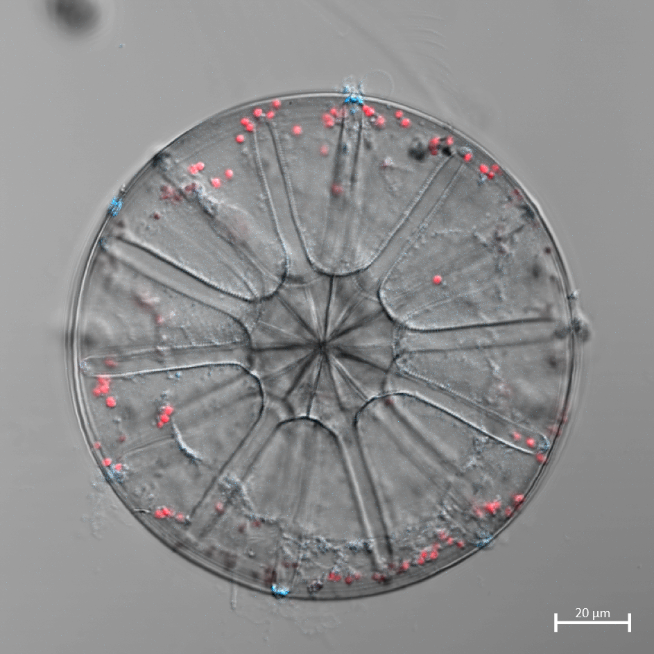 Microscopic view of a diatom, round, similar to a wheel with spokes, with a multitude of small colored dots.