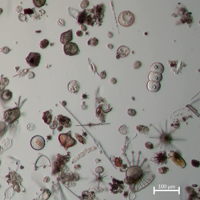 Microscopic image of various marine diatoms and plankton with diverse shapes and sizes, set against a light background.