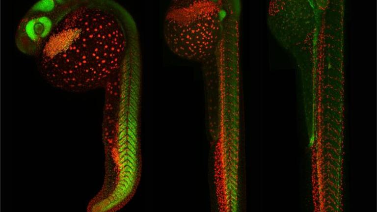 Using Zebrafish to Understand How Blood and Lymphatic Vessels Develop