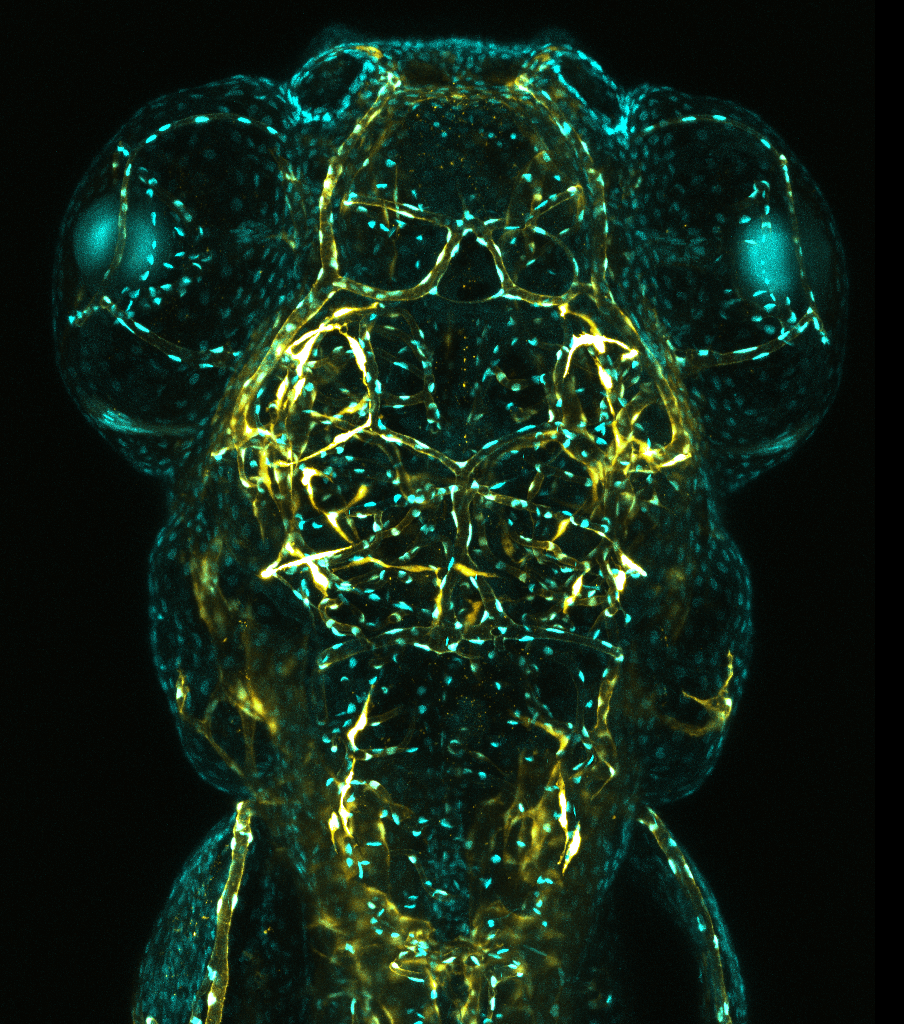 Cerebral Vessels in Zebrafish